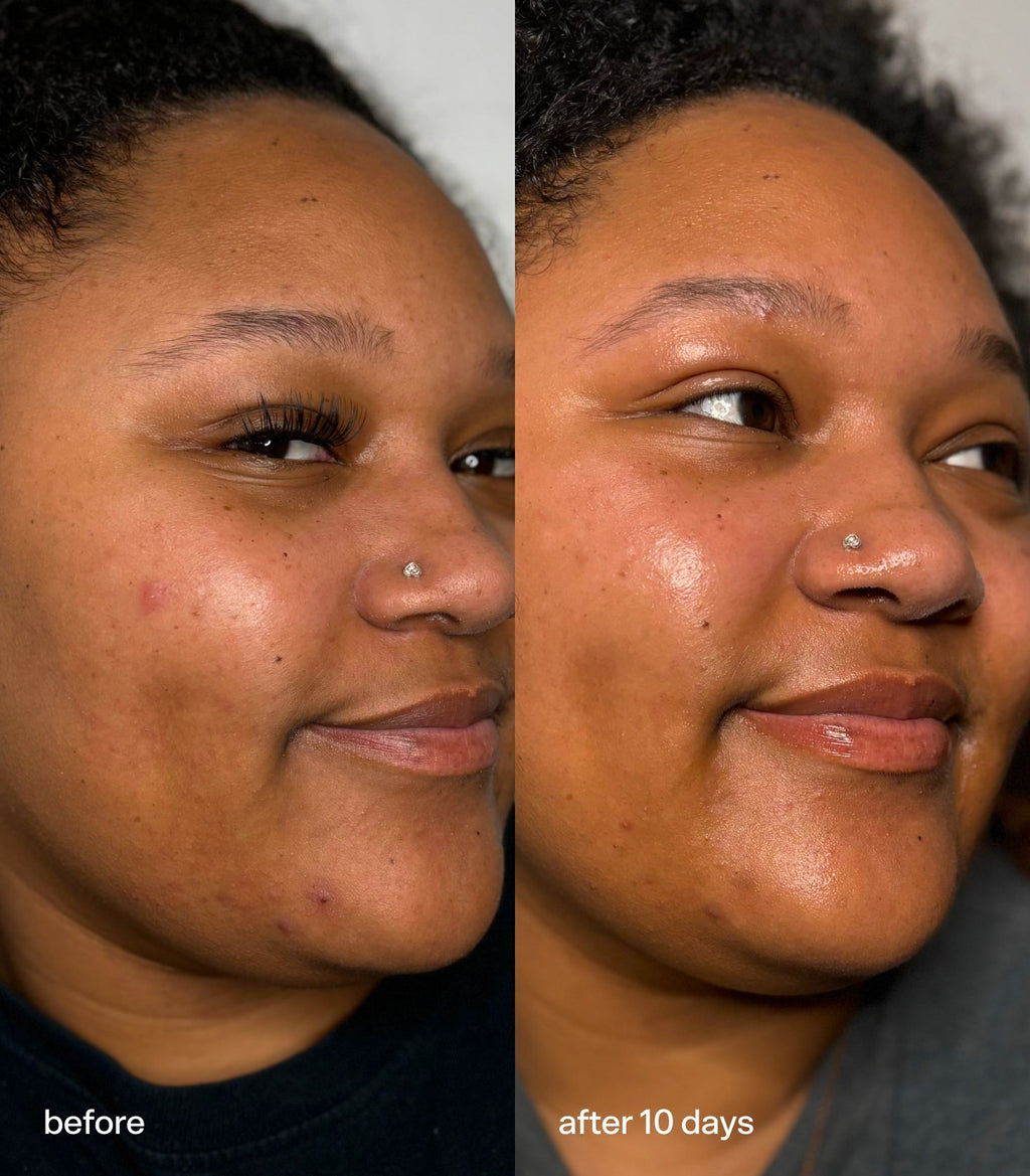 Bubble Skincare Power Wave