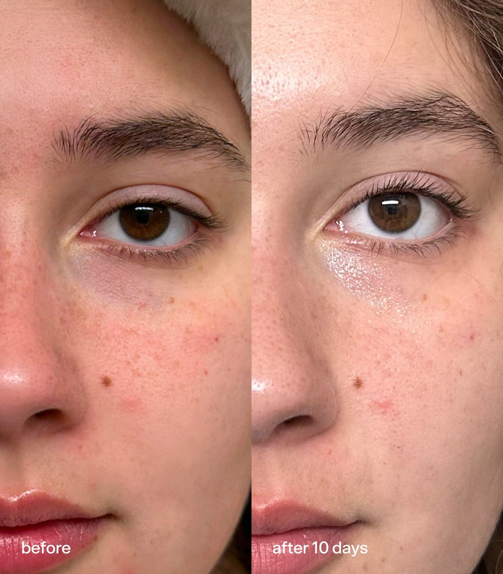 Bubble Skincare Star Dew