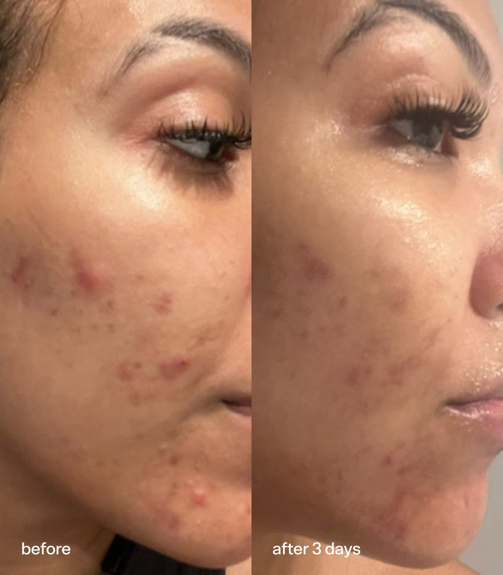 Bubble Skincare Super Clear